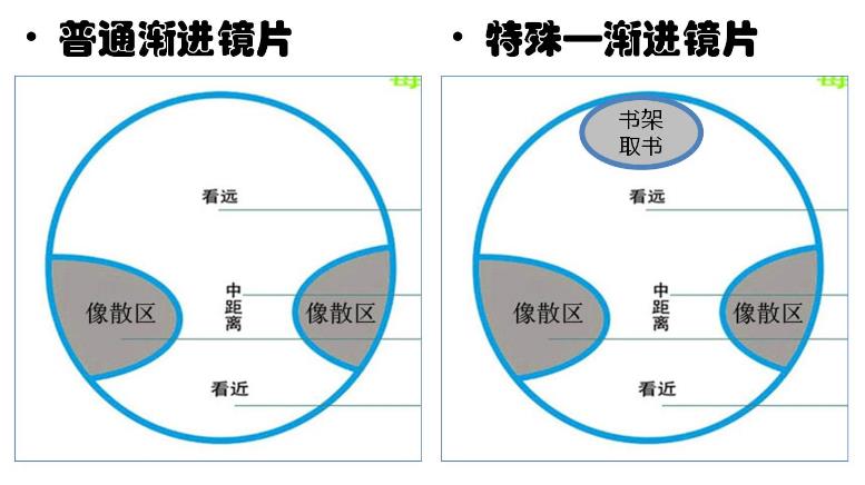 漸進(jìn)多焦鏡的原理與應(yīng)用，3個(gè)光區(qū)，看遠(yuǎn)近只需一副